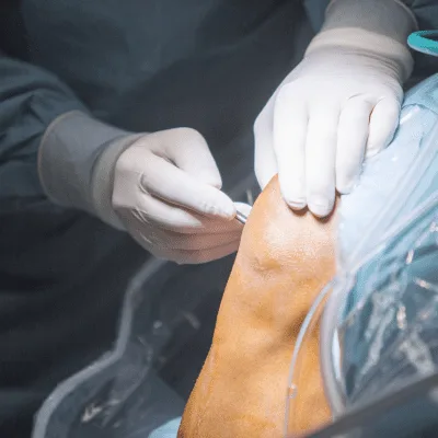 Trasplante de cartílago en Apodaca